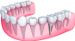 Dental Treatment