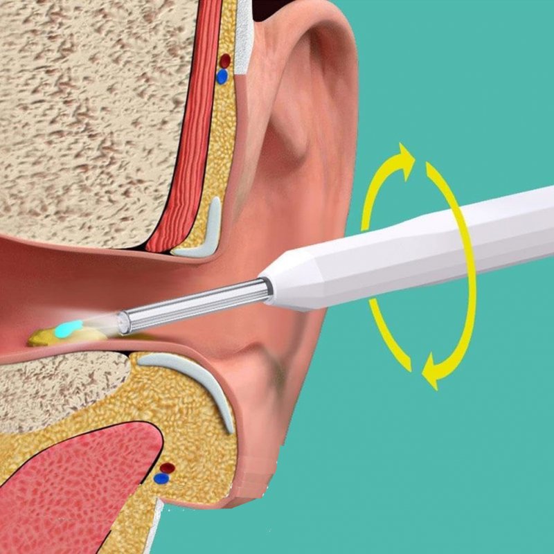 NE Series NE6/NE7 Wireless Visual Earpick NE Series NE6/NE7 Wireless Visual Earpick