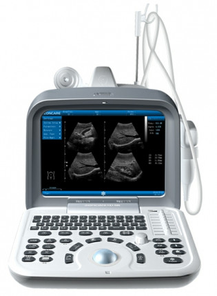 Zoncare ZQ-6602 Color Ultrasound Scanner