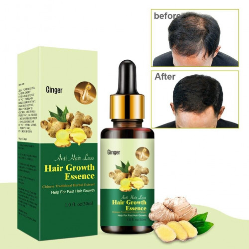 Ginger Hair Growth Essence Oil