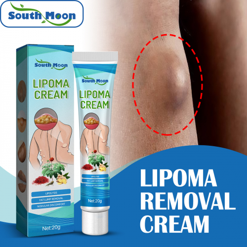 20gm Lipoma Removal Cream Treatment Relieve