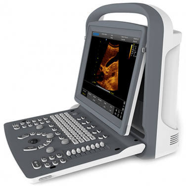Chison ECO 3 Color Ultrasound Machine