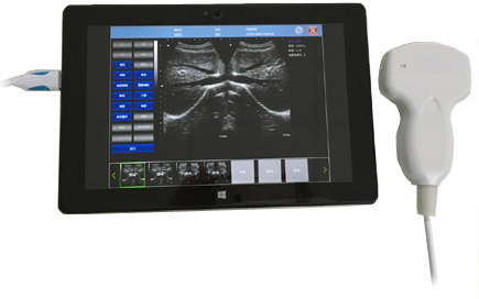 Healson HS-UP20L Handheld USB Ultrasound Scanner Machine