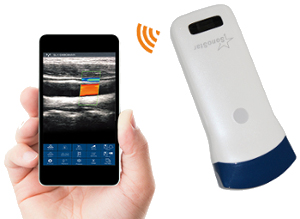 Healson UP-20C Wireless Ultrasound Scanner
